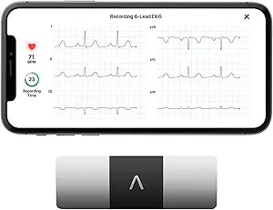 EKG